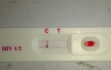 hiv抗体检测